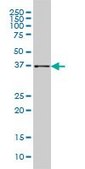 Monoclonal Anti-AKR1B10 antibody produced in mouse clone 1A6, purified immunoglobulin, buffered aqueous solution