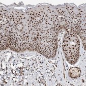 Anti-HESX1 antibody produced in rabbit Prestige Antibodies® Powered by Atlas Antibodies, affinity isolated antibody, buffered aqueous glycerol solution