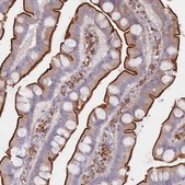 Anti-ERBIN antibody produced in rabbit Prestige Antibodies® Powered by Atlas Antibodies, affinity isolated antibody, buffered aqueous glycerol solution