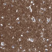 Anti-SEPT7 antibody produced in rabbit Prestige Antibodies® Powered by Atlas Antibodies, affinity isolated antibody, buffered aqueous glycerol solution, ab1