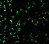 Anti-SARM Antibody from rabbit, purified by affinity chromatography