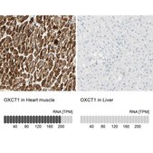 Anti-OXCT1 antibody produced in rabbit Prestige Antibodies® Powered by Atlas Antibodies, affinity isolated antibody, buffered aqueous glycerol solution