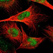 Anti-GABPA antibody produced in rabbit Prestige Antibodies® Powered by Atlas Antibodies, affinity isolated antibody, buffered aqueous glycerol solution