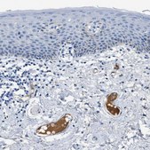 Anti-APOL1 antibody produced in rabbit Prestige Antibodies® Powered by Atlas Antibodies, affinity isolated antibody, buffered aqueous glycerol solution