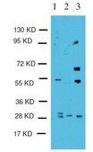 Anti-TGIF2 Antibody Upstate®, from rabbit