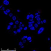 BioTracker TiYビメンチン生細胞色素 Live cell imaging probe for identifying tumor initiating cells (TICs) in a variety of epithelial cancers, including lung cancer. The TiY probe binds to vimentin expressed in TICs.