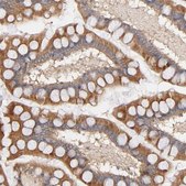 Anti-STRN3 antibody produced in rabbit Ab1, Prestige Antibodies® Powered by Atlas Antibodies, affinity isolated antibody, buffered aqueous glycerol solution