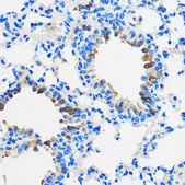 Anti-PPAR gamma antibody produced in rabbit
