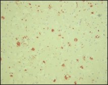 Anti-β-Amyloid antibody, Mouse monoclonal clone BAM-10, purified from hybridoma cell culture