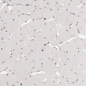 Anti-SIX1 antibody produced in rabbit Prestige Antibodies® Powered by Atlas Antibodies, affinity isolated antibody, buffered aqueous glycerol solution