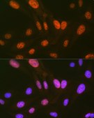 Anti-HIPK2 Antibody, clone 3Z5P6, Rabbit Monoclonal