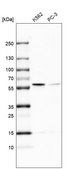 Anti-TROVE2 antibody produced in rabbit Prestige Antibodies® Powered by Atlas Antibodies, affinity isolated antibody