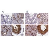 Anti-ISYNA1 antibody produced in rabbit Prestige Antibodies® Powered by Atlas Antibodies, affinity isolated antibody, buffered aqueous glycerol solution