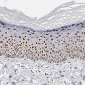 Anti-FOSL2 antibody produced in rabbit Prestige Antibodies® Powered by Atlas Antibodies, affinity isolated antibody, buffered aqueous glycerol solution