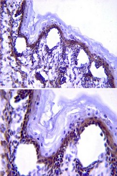 Anti-Fibrillin (Pan) Antibody, clone 689 clone 689, from mouse
