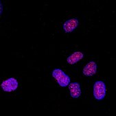 Anti-monomethyl-Histone H3 (Lys4) Antibody Upstate®, from rabbit