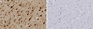 Anti-GRP78 Antibody, clone 1N6 ZooMAb® Rabbit Monoclonal recombinant, expressed in HEK 293 cells