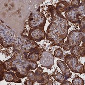 Anti-PLA2G15 antibody produced in rabbit Prestige Antibodies® Powered by Atlas Antibodies, affinity isolated antibody, buffered aqueous glycerol solution