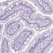 Anti-KRT5 antibody produced in rabbit Prestige Antibodies® Powered by Atlas Antibodies, affinity isolated antibody, buffered aqueous glycerol solution