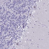 Anti-NOC2L antibody produced in rabbit Prestige Antibodies® Powered by Atlas Antibodies, affinity isolated antibody, buffered aqueous glycerol solution