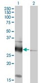 Anti-VAPB antibody produced in mouse purified immunoglobulin, buffered aqueous solution