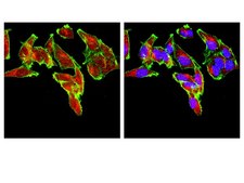 Anti-PI3 Kinase Antibody, p110β from rabbit, purified by affinity chromatography