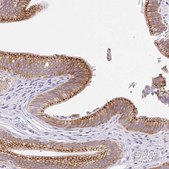 Anti-TRAF4 antibody produced in rabbit Prestige Antibodies® Powered by Atlas Antibodies, affinity isolated antibody, buffered aqueous glycerol solution
