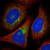 Anti-VTI1B antibody produced in rabbit Prestige Antibodies® Powered by Atlas Antibodies, affinity isolated antibody, buffered aqueous glycerol solution