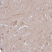 Anti-CAB39L antibody produced in rabbit Prestige Antibodies® Powered by Atlas Antibodies, affinity isolated antibody, buffered aqueous glycerol solution