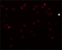 Anti-TRIP6 antibody produced in rabbit affinity isolated antibody, buffered aqueous solution