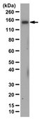 Anti-LARS Antibody from rabbit, purified by affinity chromatography