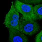 Anti-AKR1B10 antibody produced in rabbit Prestige Antibodies® Powered by Atlas Antibodies, affinity isolated antibody, buffered aqueous glycerol solution