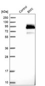 Anti-BMX antibody produced in rabbit Prestige Antibodies® Powered by Atlas Antibodies, affinity isolated antibody, buffered aqueous glycerol solution