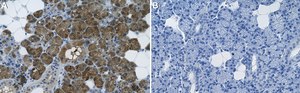 Anti-3-PGDH Antibody, clone TK-08 13A8 clone TK-08 13A8, from mouse