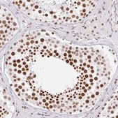 Anti-SRSF10 antibody produced in rabbit Prestige Antibodies® Powered by Atlas Antibodies, affinity isolated antibody, buffered aqueous glycerol solution