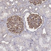 Anti-MYH9 Prestige Antibodies® Powered by Atlas Antibodies, affinity isolated antibody
