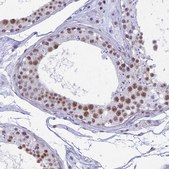 Anti-SRSF5 antibody produced in rabbit Prestige Antibodies® Powered by Atlas Antibodies, affinity isolated antibody, buffered aqueous glycerol solution