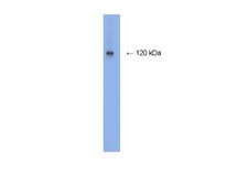 抗NMDAR1抗体、ウサギモノクローナル culture supernatant, clone 1.17.2.6, Chemicon®