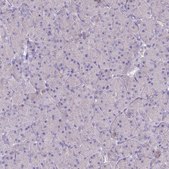 Anti-BLNK antibody produced in rabbit Prestige Antibodies® Powered by Atlas Antibodies, affinity isolated antibody, buffered aqueous glycerol solution