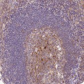 Anti-OMA1 antibody produced in rabbit Prestige Antibodies® Powered by Atlas Antibodies, affinity isolated antibody, buffered aqueous glycerol solution