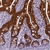Anti-AKR1B10 antibody produced in rabbit Prestige Antibodies® Powered by Atlas Antibodies, affinity isolated antibody, buffered aqueous glycerol solution