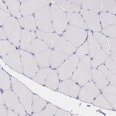Anti-THSD7A antibody produced in rabbit Prestige Antibodies® Powered by Atlas Antibodies, affinity isolated antibody, buffered aqueous glycerol solution