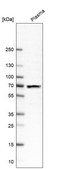 Anti-PTEN antibody produced in rabbit Prestige Antibodies® Powered by Atlas Antibodies, affinity isolated antibody, buffered aqueous glycerol solution