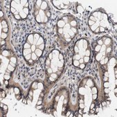 Anti-CYB561 antibody produced in rabbit Prestige Antibodies® Powered by Atlas Antibodies, affinity isolated antibody, buffered aqueous glycerol solution