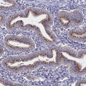 Anti-NSUN6 antibody produced in rabbit Prestige Antibodies® Powered by Atlas Antibodies, affinity isolated antibody, buffered aqueous glycerol solution