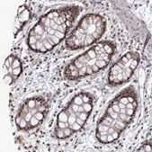 Anti-WBP1L antibody produced in rabbit Prestige Antibodies® Powered by Atlas Antibodies, affinity isolated antibody, buffered aqueous glycerol solution