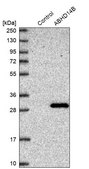 Anti-ABHD14B antibody produced in rabbit Prestige Antibodies® Powered by Atlas Antibodies, affinity isolated antibody, buffered aqueous glycerol solution