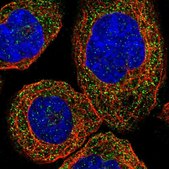 Anti-ZDHHC13 antibody produced in rabbit Prestige Antibodies® Powered by Atlas Antibodies, affinity isolated antibody, buffered aqueous glycerol solution