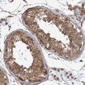 Anti-ARHGEF11 antibody produced in rabbit Prestige Antibodies® Powered by Atlas Antibodies, affinity isolated antibody, buffered aqueous glycerol solution