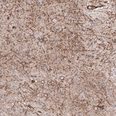 Anti-SLC16A2 antibody produced in rabbit Prestige Antibodies® Powered by Atlas Antibodies, affinity isolated antibody, buffered aqueous glycerol solution